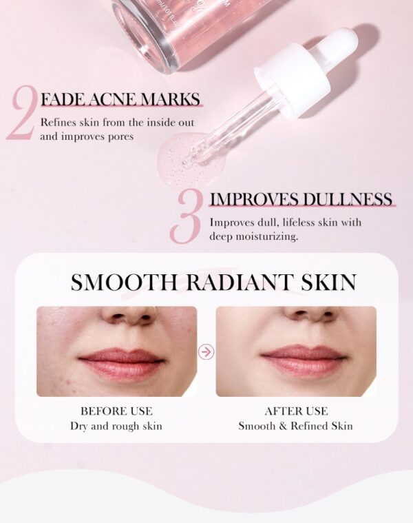 Anua Wonder Peach 70% Niacinamide Serum - Image 4